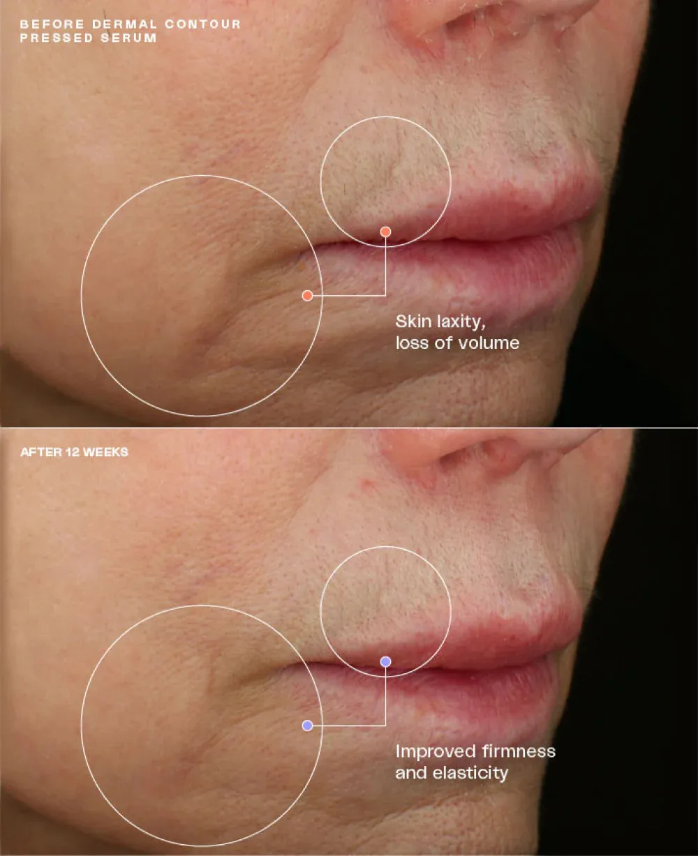 SENTE HydraFirm (Dermal Contour Pressed Serum)