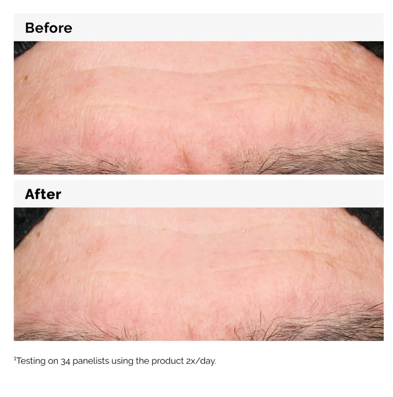 The Ordinary Hyaluronic Acid 2% B5